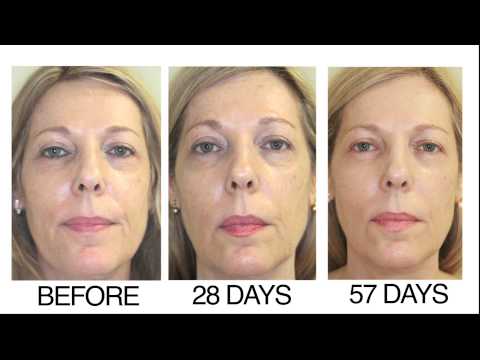 RejuveMD Growth Factor Anti-Aging Serums Results in 28 Days