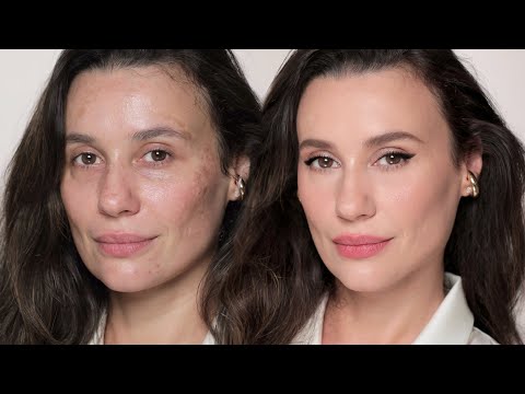 I've tried different methods and this is the best way to cover melasma | ALI ANDREEA