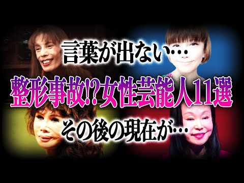 【衝撃】整形で顔面崩壊した女性芸能人11選！！現在の姿に驚きが隠せない…