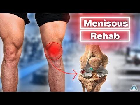 Meniscus Injuries: Surgery Signs, Rehab Exercises and Expert Tips!