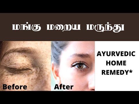 மங்கு மறைய மருந்து | Melasma ayurvedic cure | Mangu poga tips