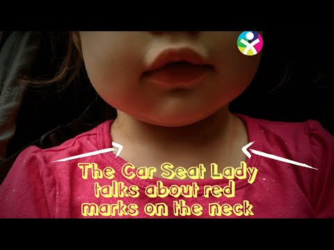 Help! Car Seat Straps Leaving Red Marks on Baby's Neck