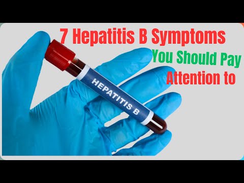 7 Hepatitis B Symptoms You Should Know