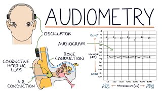 Understanding Audiometry and Audiograms