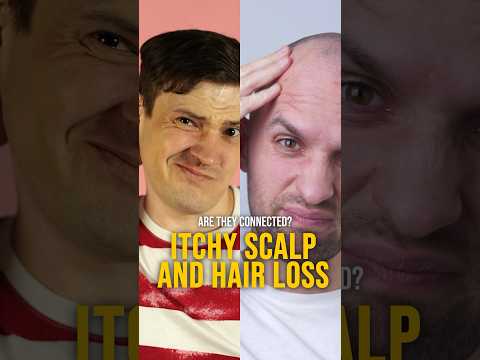 Itchy Scalp and Hair Loss - Are They Connected? #hairloss