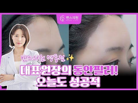 고급진 인상을 만드는 의외의 필러부위 Best 3 ㅣ 티 안나게 예뻐지고 싶다면?!🔍