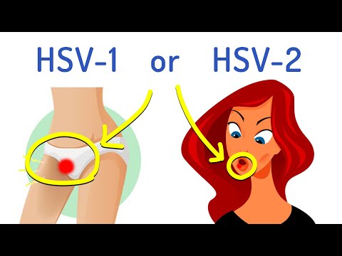 What's the Difference Between HSV-1 and HSV-2 (Explained in 2 minutes)