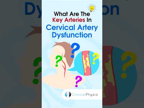 Cervical Artery Dysfunction #physicaltherapy #physiotheraphy #anatomy