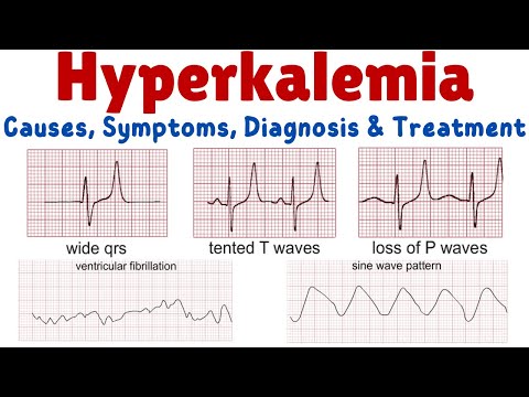 Hyperkalemia (High Potassium) – Causes, Symptoms, Diagnosis and Treatment