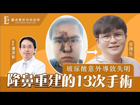 【隆鼻重建手術全記錄】玻尿酸隆鼻意外導致失明 重建13次每次都比原來更好！ 蕭彥彰醫師X冒牌生｜麗舍整形外科