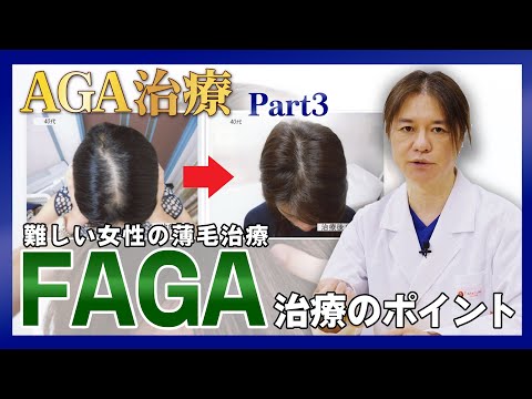 【FAGA治療】難しい女性の薄毛治療を症例とともに徹底解説！AGA治療について語る 最終話！！【薄毛】