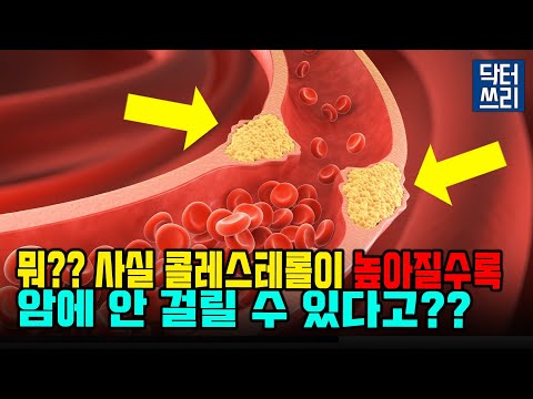 콜레스테롤 높으면 암에 걸릴까? 고지혈증약은 암을 예방할까? [스타틴의 진실]