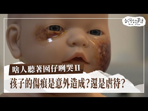 孩子身上傷痕是意外造成？還是虐待？醫生用專業找出證據，為孩子發聲！[ 啥人聽著囡仔咧哭Ⅱ ] 2024.05.26 台灣記事簿 第242集