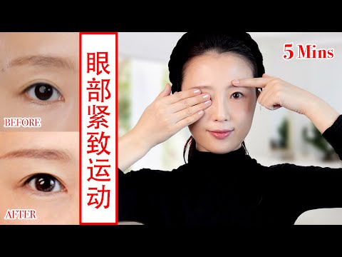 【How to tighten droopy eyelids】5 Mins Eye Exercises ，get rid of eye bags & dark circles