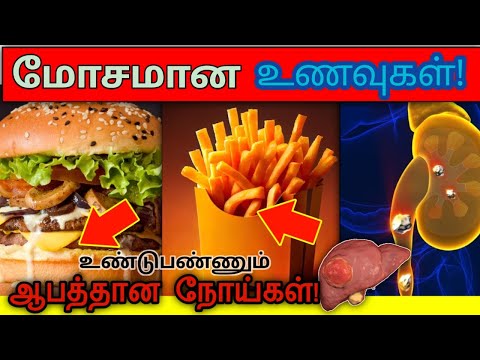 மோசமான நோய்களை உண்டுபண்ணும் மோசமான உணவுகள்! | Worst foods cause Worst diseases | STAR LABORATORY