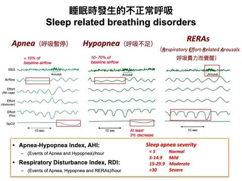 20210408 智慧醫療在睡眠呼吸障礙的應用