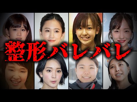 バレバレ！整形をしている女性芸能人TOP10　part2