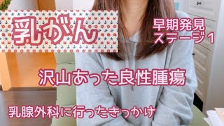 【乳がん】#1病院に行った理由〜細胞診　50代　早期発見ステージ1