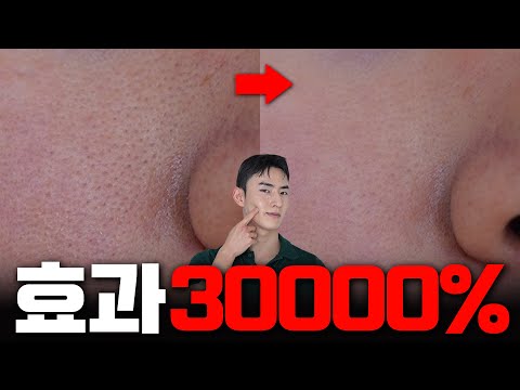 무조건 효과 보는 모공 줄어드는 홈케어 방법🔥🔥