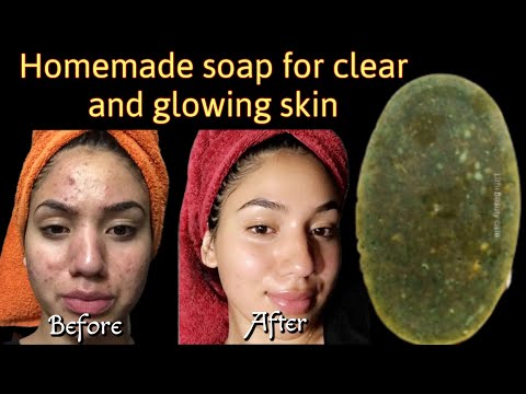 Homemade soap for clear and glowing skin// homemade soap//soap making at home