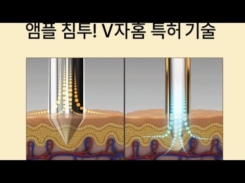 🙏스킨부스터 이제 홈케어로 시술 하세요🙏🎊라쥴탑셀러데이🎊