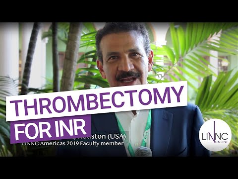 Is thrombectomy reserved for INR? Orlando M. Diaz