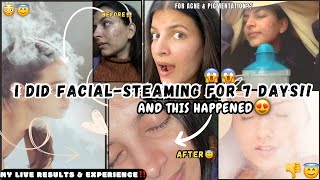 I Did *FACIAL-STEAMING* for Continuously 1 Week & This Happened!😱 LIVE Results||Mitali Sharma🤗😇✨