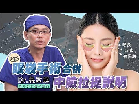 經眼下拉皮手術 | 眼袋手術能讓蘋果肌下垂及法令紋一併解決？眼袋手術合併中臉拉提說明 Dr.吳孟穎醫師 台北教主醫美整形BishopClinic