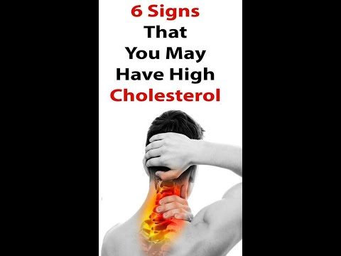 5 Remedies for High Cholesterol #Shorts