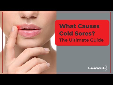 What Causes Cold Sores? The Ultimate Guide