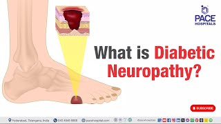 Diabetic Neuropathy | What is Diabetic Neuropathy? | #diabeticneuropathy