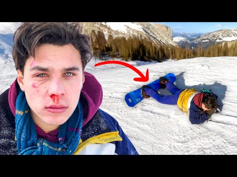 My Worst Snowboard Accident