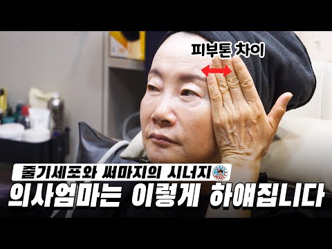 레이져에 반응 안하는 기미와 모공 뽀얗고 하얗게 주름 없는 피부 만들기(당일에도 티가 안나요)