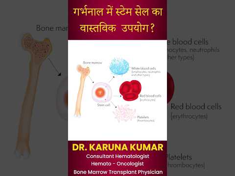 गर्भनाल में स्टेम सेल का वास्तविक उपयोग?#stemcell #stemcelltherapy #stemcelltreatment #drkarunakumar