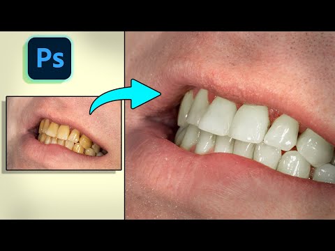 How To Whiten the teeth In #adobe #photoshop In One Minute | Tutorial | Photoshop Tricks 2025