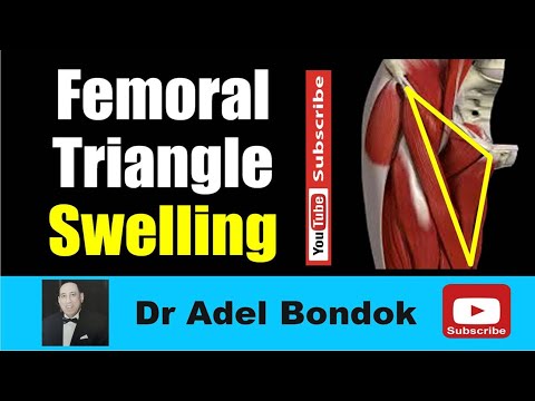 Femoral Triangle and Groin Swelling, Dr Adel Bondok Making Anatomy Easy