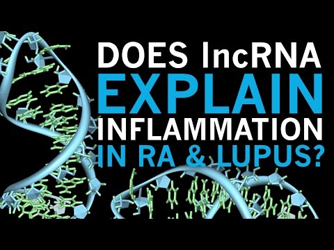 Does lncRNA Explain Inflammation in RA & Lupus?