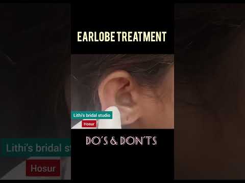 Earlobe surgery without pain 👂// earlobe surgery #shorts #youtubeshort