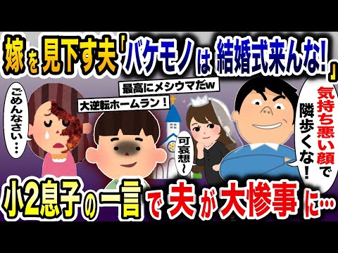 顔に火傷を負った私に夫「義弟の結婚式にバケモノは来るな！」→結婚式当日、小2息子の一言で夫と浮気相手が大惨事にwww【2ch修羅場スレ・ゆっくり解説】