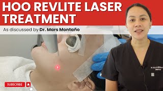 REVLITE LASER TREATMENT FOR HYPERPIGMENTATION, ENLARGED PORES AND PHOTODAMAGED SKIN