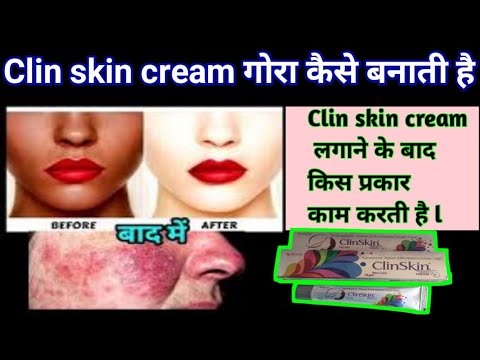 ClinSkin cream किस प्रकार काम करती है l How does ClinSkin cream work? #CNGAJBHIYE #clinskincream