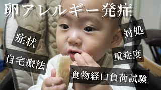 【卵アレルギー】我が子は卵アレルギー！発症〜対処方法〜現在