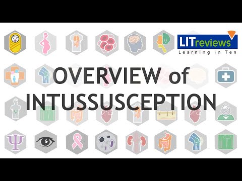 Overview of Intussusception