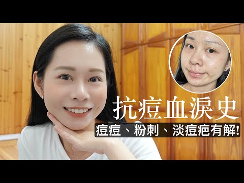 2023｜痘痘肌必看！抗痘保養品推薦，粉刺痘痘怎麼保養？如何修復爛臉，讓痘痘跟你say goodbye~ #cerave #melvita玫瑰花粹 #痘膚潤