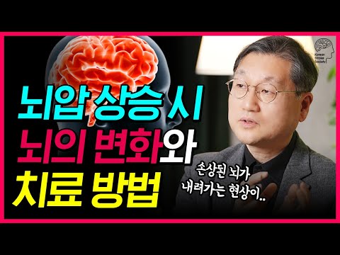 뇌압이 오르면 머리속에선 이런일이?! | 합병증오기 전 ‘골든타임'에 해야할 치료법