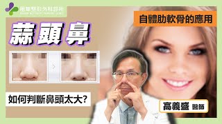 【風華聯合診所】蒜頭鼻手術的治療方式｜什麼是蒜頭鼻｜高義盛醫師｜風華整形外科診所｜