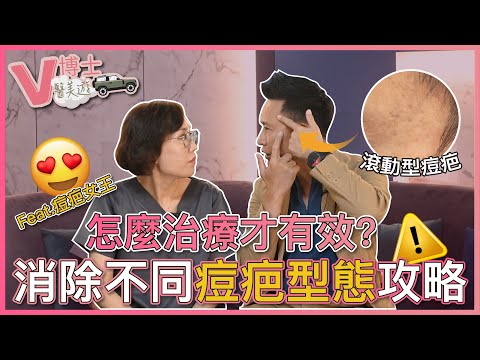 消除不同痘疤型態攻略🔥怎麼治療才有效？ft. 痘疤女王｜V博士醫美遊