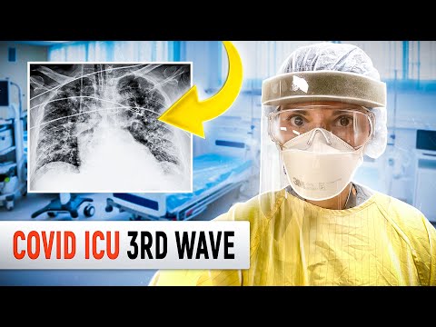 DAY IN THE LIFE OF A DOCTOR: COVID-19 ICU 3rd Wave in Canada