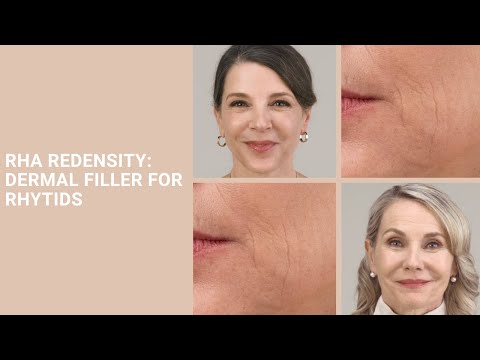 RHA Redensity: Dermal Filler For Rhytids