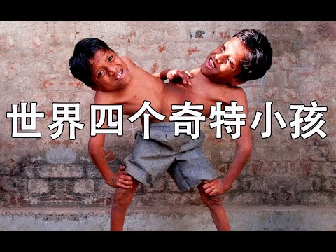 世界上四个奇特的小孩，你见过一辈子生活在盆子里的人么？